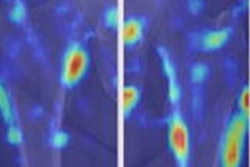 2022 05 25 23 03 3956 2022 05 27 Ai Osteoporosis 20220525235338