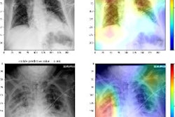 2022 06 02 18 19 9901 2022 06 03 Ai X Ray Covid 400