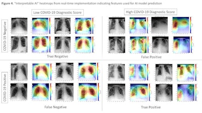 'Interpretable AI' heatmaps from real-time implementation indicating features used for AI model prediction. COVID-19 negative and positive chest radiographs (gray) and representative heatmaps (colored) from real-time implementation output are shown. Features of importance for model predictions are represented by the red end of the heatmap spectrum, and blue represents features of least importance. Representative images with both high and low diagnostic scores are provided. Black boxes were added for the purpose of blocking any potential patient information for publication purposes. Image courtesy of Radiology: Artificial Intelligence.