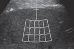 2022 06 07 16 34 7733 2022 06 07 Ajr Us Hepatic Steatosis 20220607165611