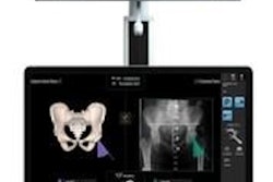 2022 06 09 21 19 4593 Smith Nephew Hip 400