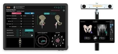 Smith & Nephew's Ri.hip Modeler and Ri.hip Navigation for its Cori Surgical System. Image courtesy of Smith & Nephew.