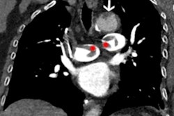 2022 06 14 22 43 1788 2022 06 14 Radiology Rogers Figure2 400