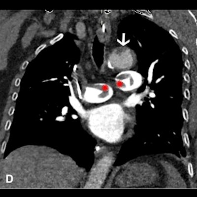 2022 06 14 22 43 1788 2022 06 14 Radiology Rogers Figure2 400