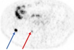 2022 06 15 17 59 3671 2022 06 15 Low Res Snmmi2202 Abstract Ma 20220615171118