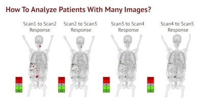 Representative PET/CT images of a patient used in developing the AI model. Image courtesy of Amy Weisman, PhD.