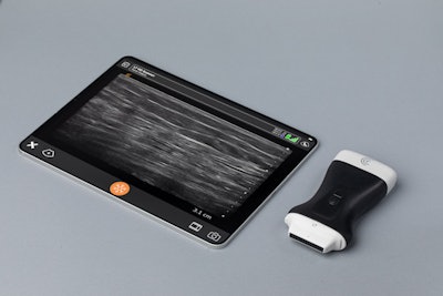Clarius L7 HD3 wireless ultrasound scanner. Image courtesy of Clarius Mobile Health.