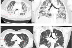 2022 06 22 00 36 9912 2022 06 21 Radiology Tsakok Image 400