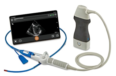 The Zura handheld hemodynamic ultrasound scanner.