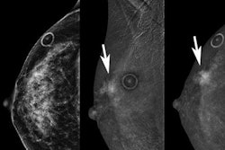 2022 07 12 20 19 4518 2022 07 12 Radiology Cem Enhancement 20220712203339