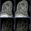 2022 07 13 21 33 8040 2022 07 13 Ecr Mri Breast Imaging 20220713215738