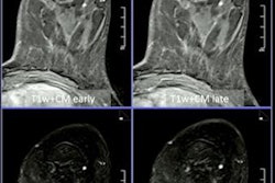 2022 07 13 21 33 8040 2022 07 13 Ecr Mri Breast Imaging 20220713215738