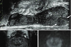 2022 07 19 20 18 2031 2022 07 19 Radiology Microultrasound Prostate 400