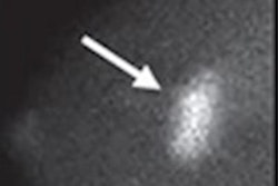 2022 07 20 23 45 8808 2022 07 20 Ajr Molecular Breast Imaging 20220720233750