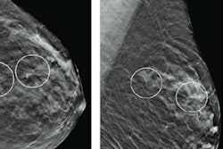 2022 07 28 20 09 9956 2022 07 27 Ajr Dbt Architectural Distortions 400