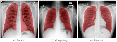 Sample images from each of the three databases used to train the lung segmentation algorithms.