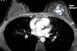 2022 07 29 21 29 2978 2022 07 26 Radiology Dce Mri Chemotherapy Predictors 400