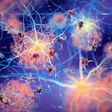 2022 08 01 18 21 3281 Brain Amyloid Plaque Neuron 400