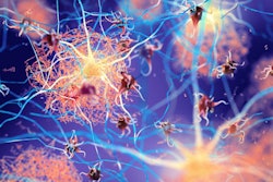 2022 08 01 18 21 3281 Brain Amyloid Plaque Neuron 400