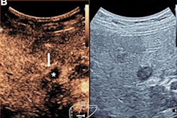 2022 08 02 21 12 0949 2022 08 02 Radiology Wu Ceus Liver Lesions 400