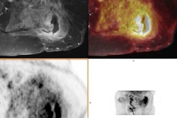 2022 08 09 23 22 4500 2022 08 10 Pet Mri Osteomyelitis 20220809232442
