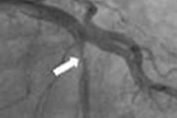 2022 08 12 22 53 0555 2022 08 12 Ai Stent 20220812220746