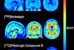 2022 08 15 20 17 1414 2022 08 16 Skull Tau 20220815203006