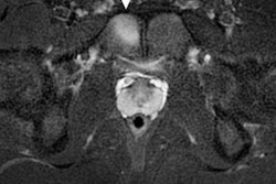 2022 08 16 16 33 1593 2022 08 17 Mri Olympics 1 20220816164208