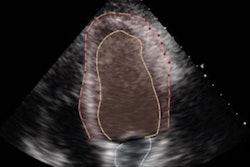 2022 08 16 18 41 8211 2022 08 16 Dyad 20220816180414