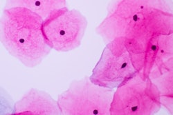 2022 08 19 16 20 0907 Squamous Epithelial Cells Cervical 400