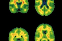 2022 08 19 23 10 0987 2022 08 22 Early Amyloid Binding 400