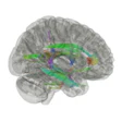 2022 08 23 17 55 2325 2022 08 23 Mri Brain 400