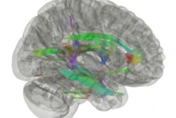 2022 08 23 17 55 2325 2022 08 23 Mri Brain 400