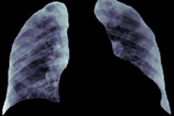 2022 08 24 22 19 2975 2022 08 25 Ai Bias 20220824223423