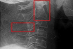 2022 08 25 17 11 6136 2022 08 26 Ai Spine Injury 400
