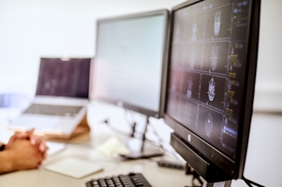 AI software for brain MRI analysis developed by Shadi Albarqouni, PhD, of the University Hospital Bonn and Helmholtz Munich. Image courtesy of Johann F. Saba of the University Hospital Bonn.