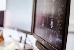 2022 08 26 23 35 6683 2022 08 29 Ai Federated 20220826230420