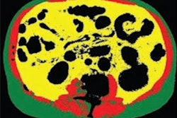 2022 08 31 17 10 1037 2022 08 31 Body Composition 400