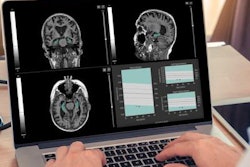 2020 02 03 20 54 1449 Qynapse Qy Score 20200203200539