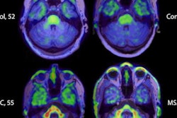 2022 03 17 15 47 6609 2022 03 17 Ac Immune Pet Image 20220317153445