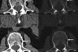 2022 09 02 21 17 9381 2022 09 06 Radiology Baffour Figure3 20220902214723