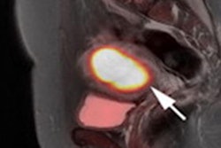 2022 09 06 16 53 1973 2022 09 07 Pet Endometrial Cancer 20220906170008