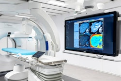 2022 09 06 20 39 6950 2022 09 07 Philips Angio Ct 400