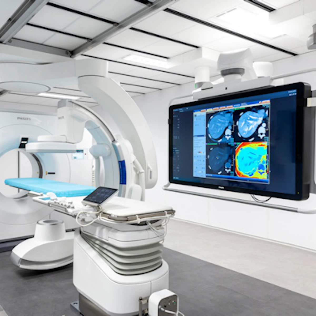 Philips reports advances in hybrid angio/CT suite with spectral CT ...