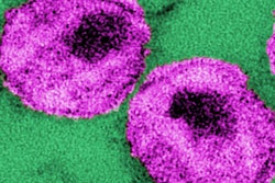 2022 09 13 18 13 4162 Hiv Virions Cdc 400