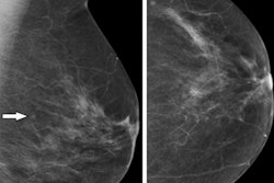 2022 09 13 22 03 0290 2022 09 13 Radiology Radiologist Radiographer Mammo 400