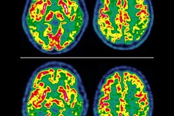 2022 09 14 17 50 5275 2022 09 15 Ultralow Dose Fdg 400