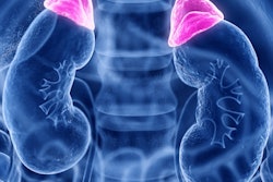 2022 09 14 23 01 0126 Adrenal Gland 400