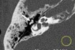 2022 09 15 20 18 6719 2022 09 15 Isct Photon Counting Image Dose Reduction 20220915205403