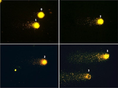 Fluorescence microscopy images (×400) showing examples of patterns of DNA damage in the comet assay. Left panel: Nucleoid structures depicting class 0 of damage (no tail) and class 1 (small tail). Middle panel: class 2 of damage (larger tail). Right panel: class 3 of damage (profound fragmentation, very large tail). Image courtesy of BMC Cardiovascular Disorders.